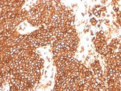 CD99 Antibody (MIC2/3478R) - Azide and BSA Free, Novus Biologicals 100